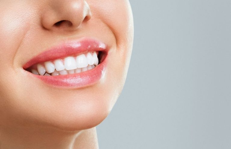 blanqueamiento dental