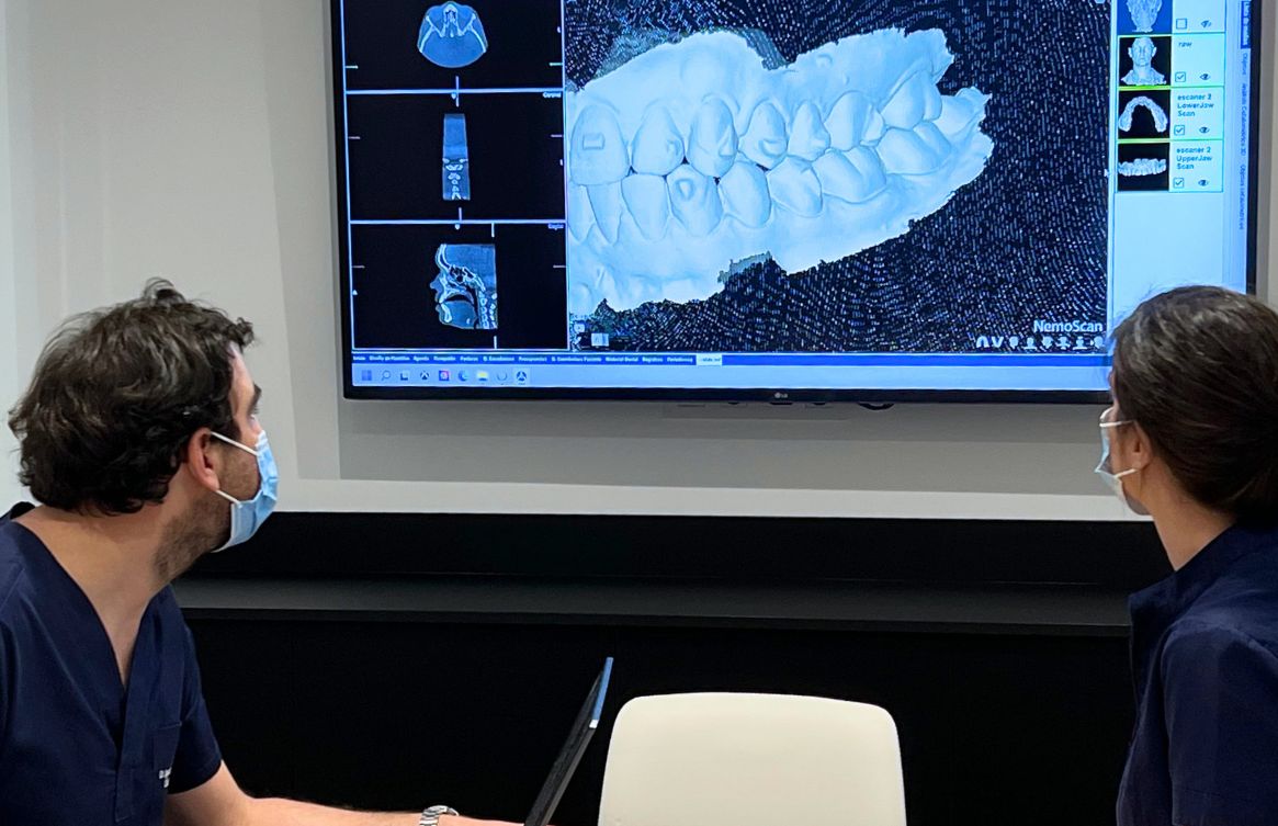 como cuidar un implante dental barakaldo